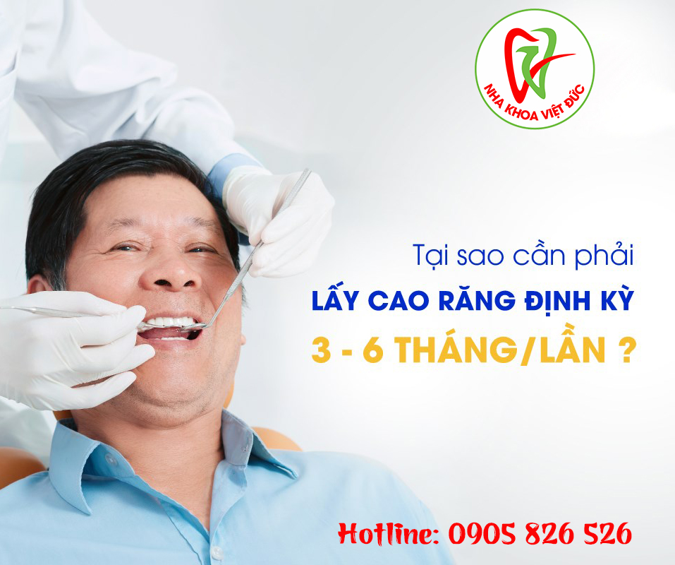 VÌ SAO PHẢI LẤY CAO RĂNG ĐỊNH KỲ 3/6 THÁNG?