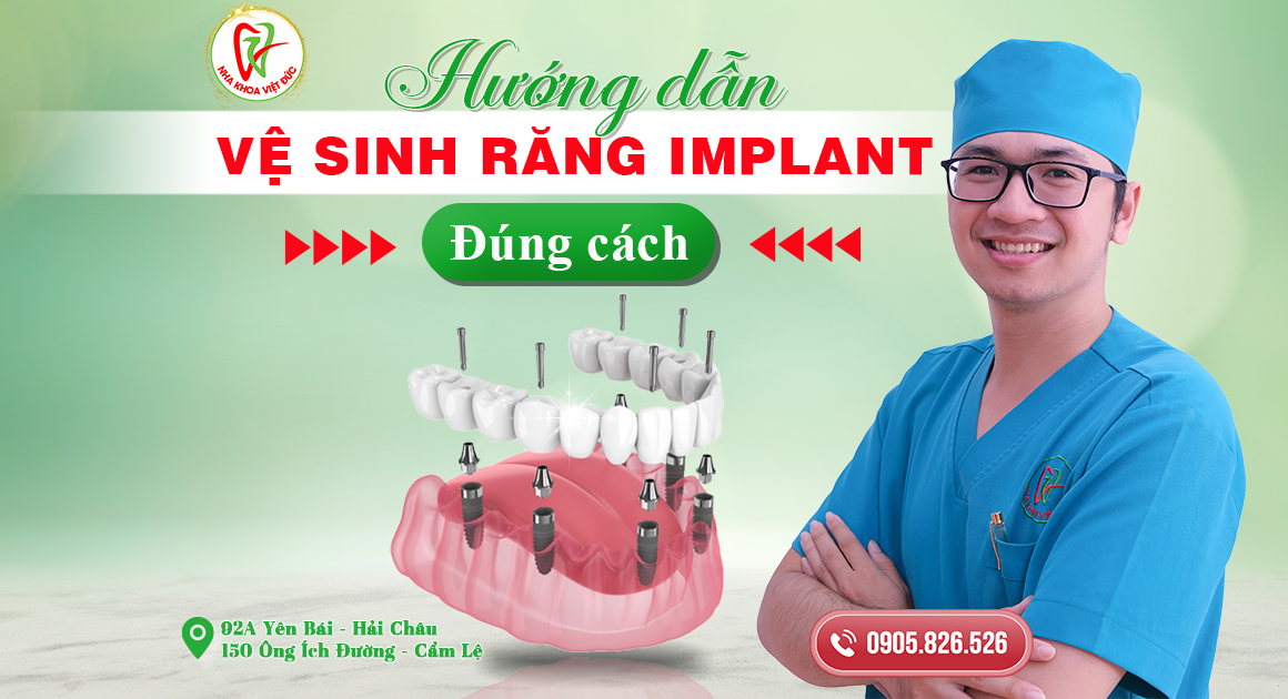 HƯỚNG DẪN VỆ SINH RĂNG IMPLANT ĐÚNG CÁCH