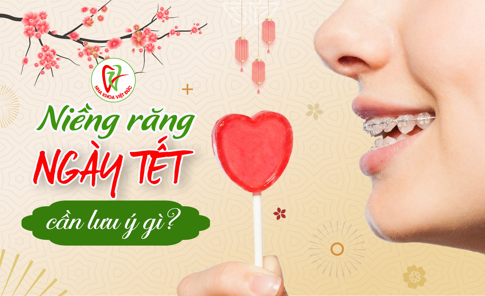 NIỀNG RĂNG NGÀY TẾT CẦN LƯU Ý GÌ?