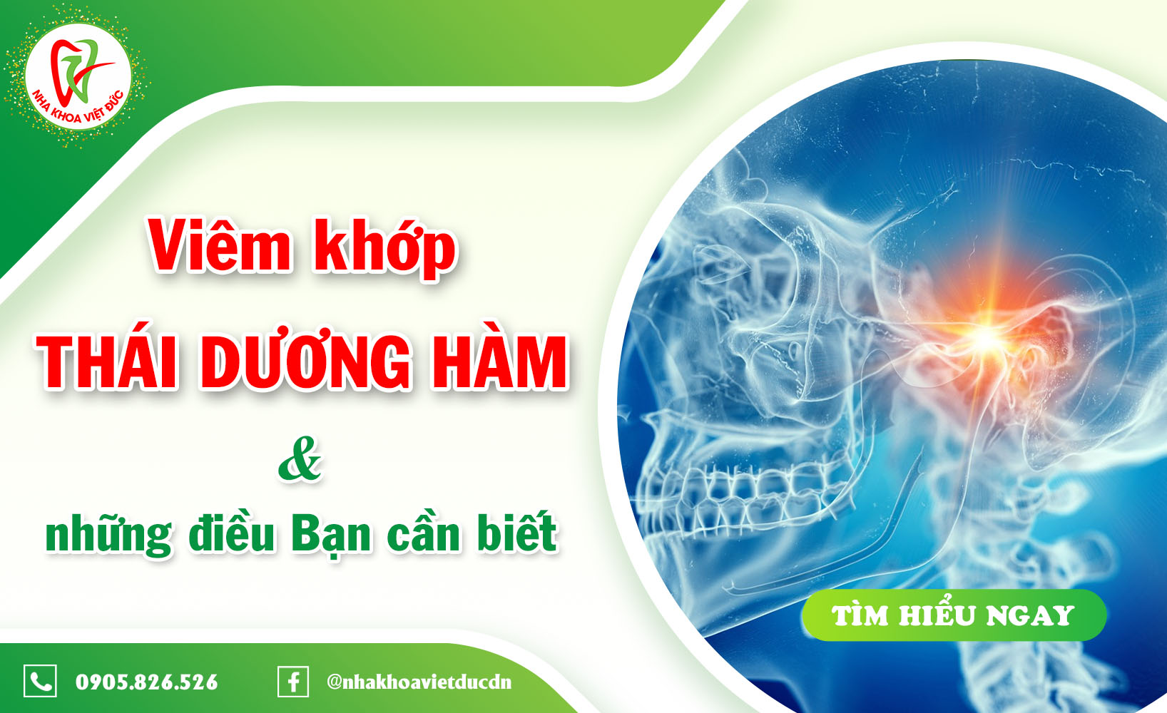 VIÊM KHỚP THÁI DƯƠNG HÀM VÀ NHỮNG ĐIỀU BẠN CẦN BIẾT