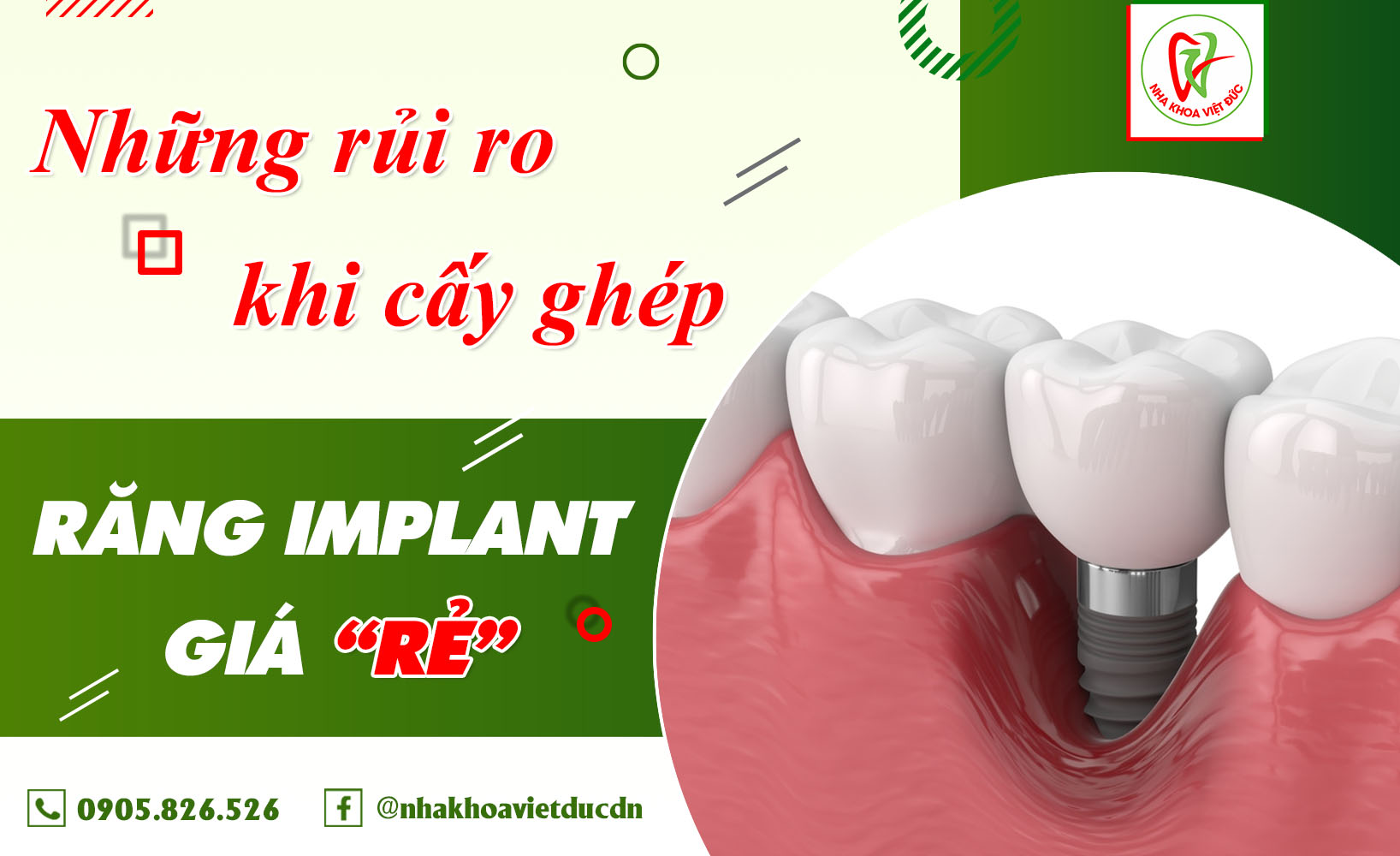 NHỮNG RỦI RO KHI CẤY GHÉP RĂNG IMPLANT GIÁ RẺ